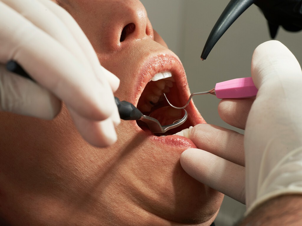En su búsqueda de turistas, Marruecos ha tenido una idea: turismo dental. A los dentistas españoles no les hace gracia